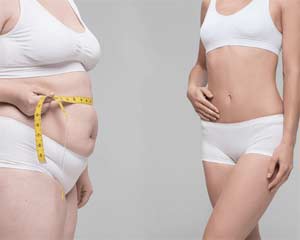Body Lift Lille Clinique Clemenceau