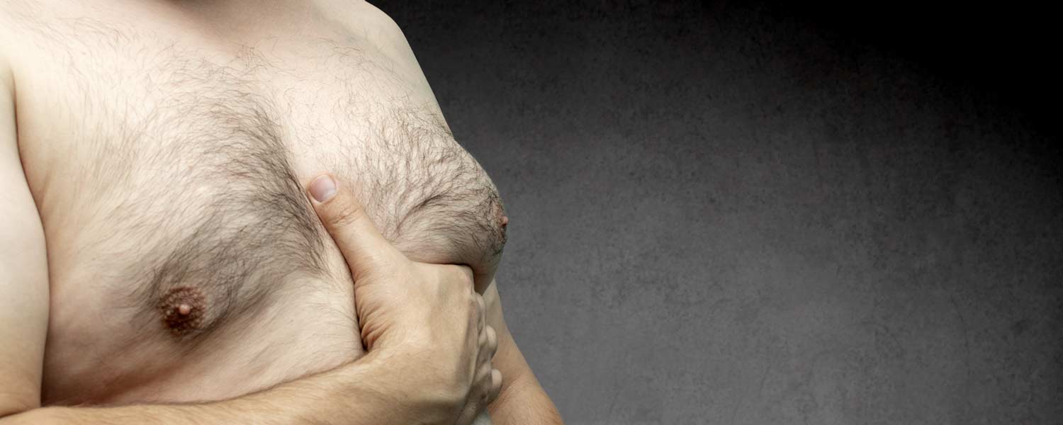 Gynecomastie par Cryolipolyse Lille