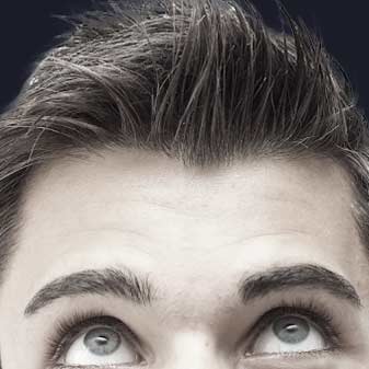 Greffe de cheveux Lille Greffe de cheveux Lille