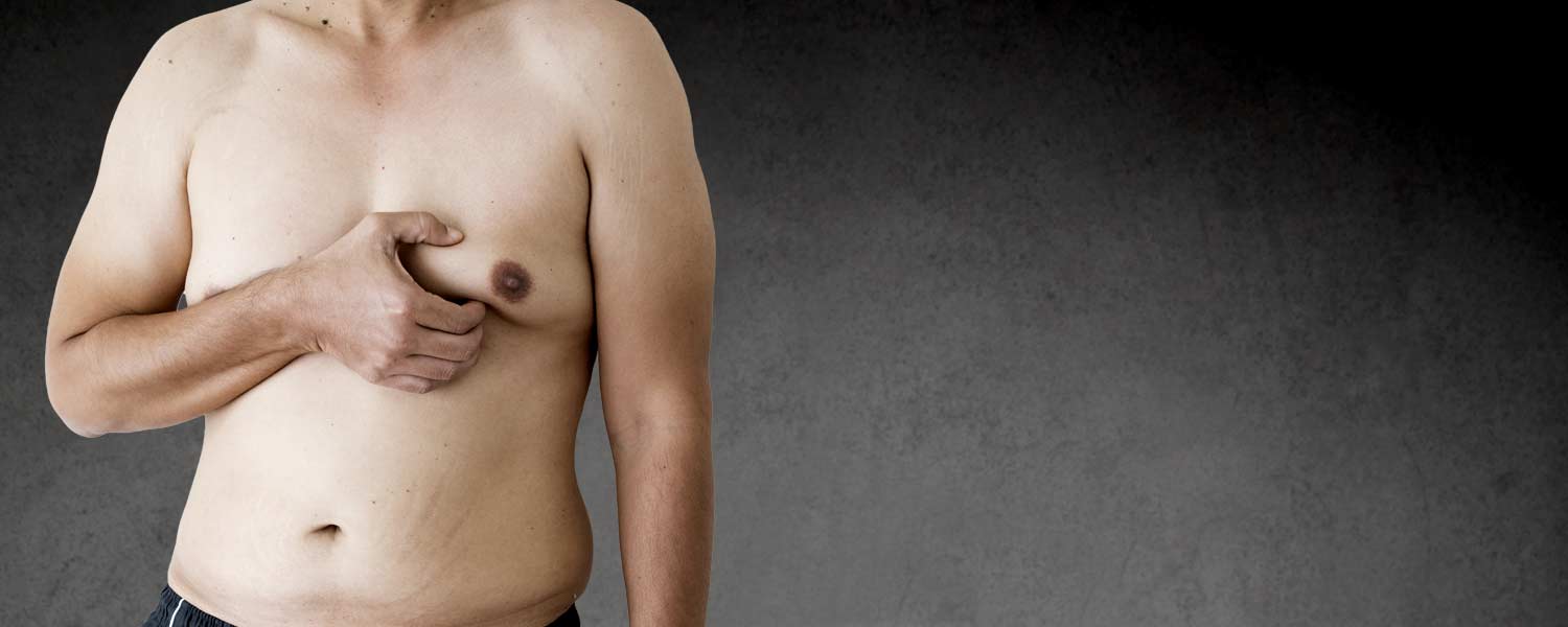 Gynecomastie Lille