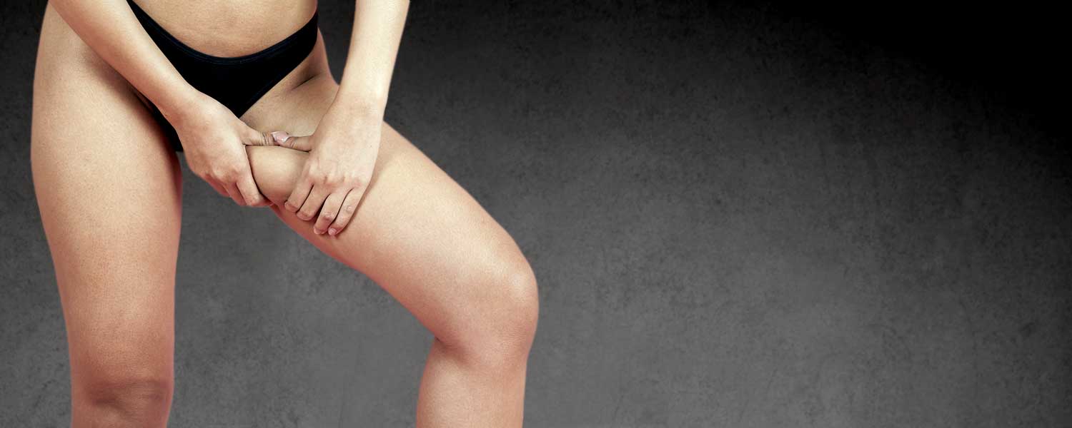 Lifting des Cuisses Lille