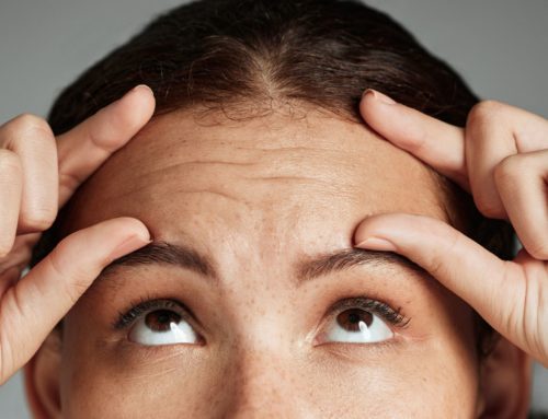 Le Botox : solution miracle pour atténuer les rides d’expression ?