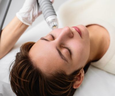 Radiofréquence Microneedling Contour des yeux à Lille