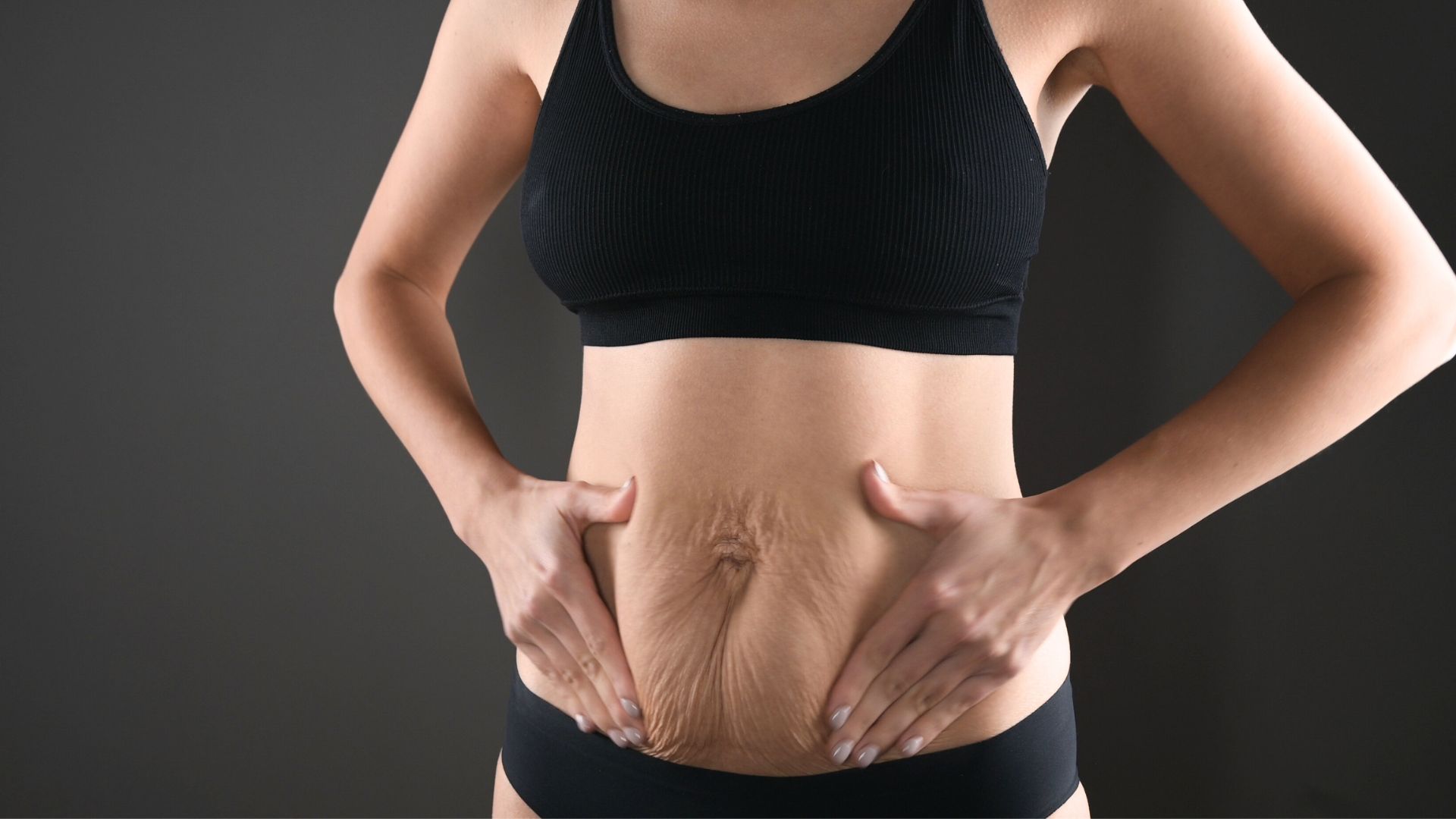 En finir avec le ventre relâché avec la plastie abdominale à la Clinique Clemenceau