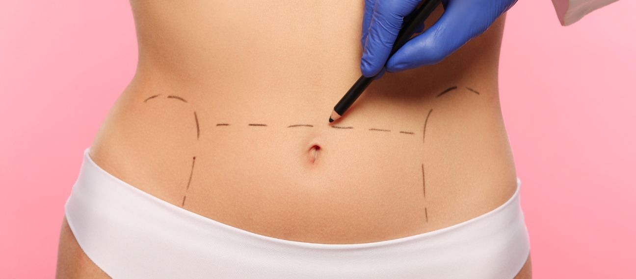 Abdominoplastie à Lille Clinique Clemenceau