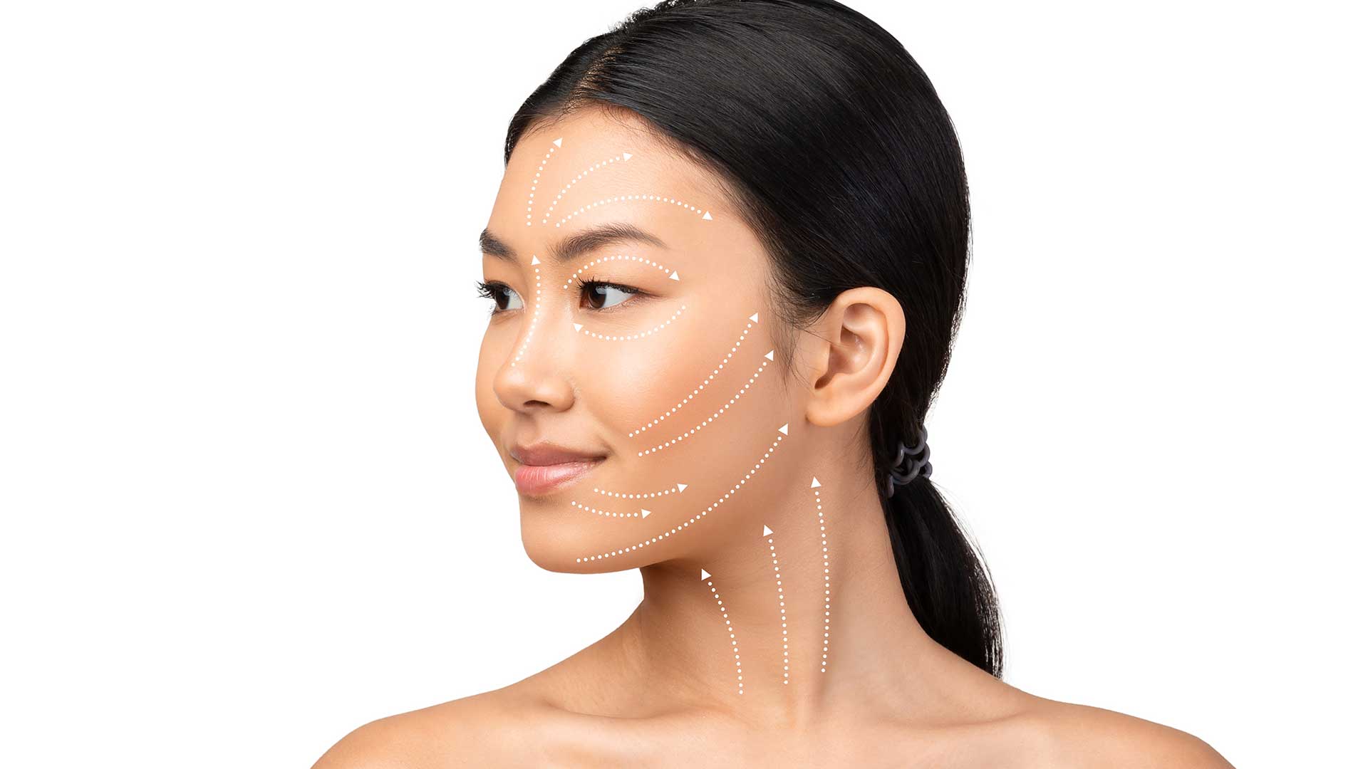 Les fils tenseurs résorbables ou permanents, pour un effet lifting sans chirurgie !
