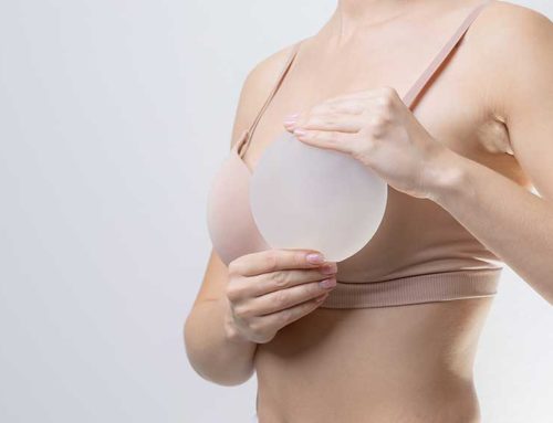 L’augmentation mammaire par prothèses : principe et suites opératoires